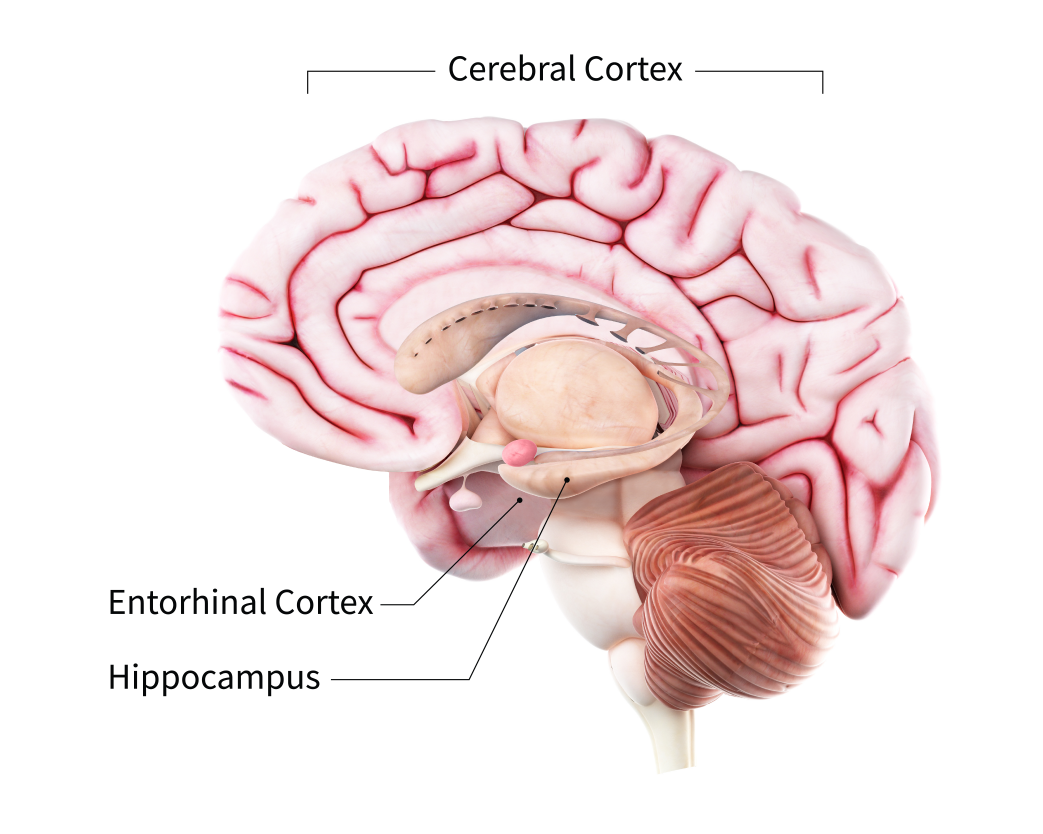 nia brain graphic alzheimers